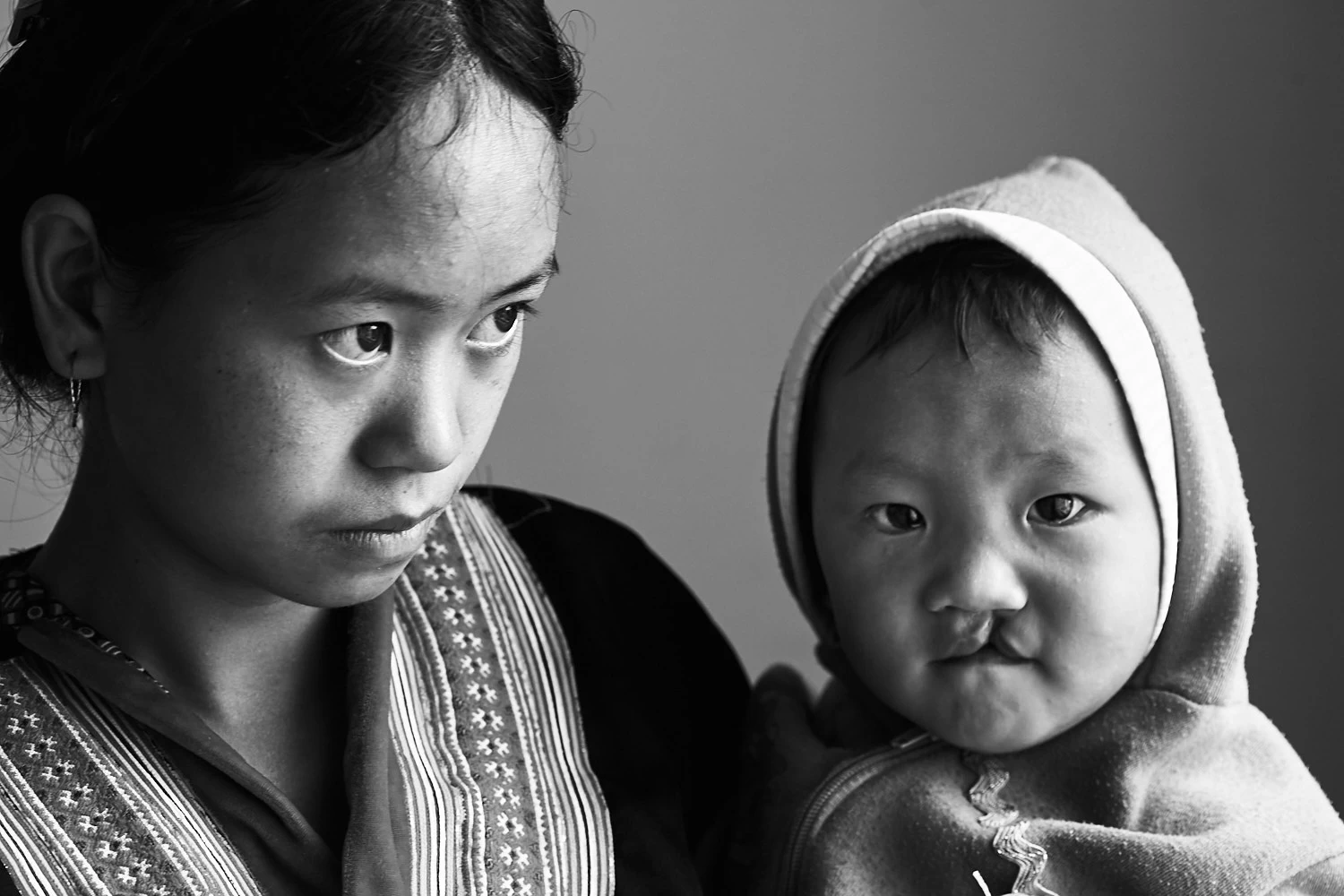 Child surgery in Vietnam
